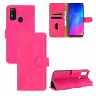 For DOOGEE N30 Solid Color Skin Feel Magnetic Buckle Horizontal Flip Calf Texture PU Leather Case with Holder & Card Slots & Wallet(Rose Red) - 1