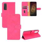 For ZTE Axon 20 5G / A20 5G Solid Color Skin Feel Magnetic Buckle Horizontal Flip Calf Texture PU Leather Case with Holder & Card Slots & Wallet(Rose Red) - 1