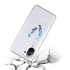 For Xiaomi Mi 11 Lite Coloured Drawing Pattern Transparent TPU Protective Case(Feather) - 3