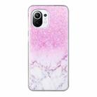 For Xiaomi Mi 11 Lite Coloured Drawing Pattern Transparent TPU Protective Case(Marble) - 1