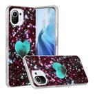 For Xiaomi Mi 11 Lite Marble Pattern Soft TPU Protective Case(Green Love) - 1