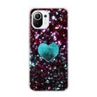 For Xiaomi Mi 11 Lite Marble Pattern Soft TPU Protective Case(Green Love) - 2
