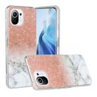 For Xiaomi Mi 11 Lite Marble Pattern Soft TPU Protective Case(White Gold) - 1