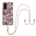 For Xiaomi Mi 10T 5G / 10T Pro 5G Electroplating Pattern IMD TPU Shockproof Case with Neck Lanyard(Pink Scales) - 1