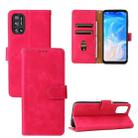 For Doogee N40 Pro Solid Color Skin Feel Magnetic Buckle Horizontal Flip PU Leather Case with Holder & Card Slots & Wallet(Rose Gold) - 1