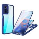 For Xiaomi Redmi Note 11 5G China Acrylic + TPU 360 Degrees Full Coverage Shockproof Phone Case(Blue) - 1