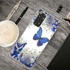 For Xiaomi Redmi Note 11 Global / Note 11S Painted Transparent TPU Phone Case(White Flower Butterfly) - 1