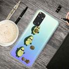 For Xiaomi Redmi Note 11 Pro 4G / 5G Global Painted Transparent TPU Phone Case(Avocado) - 1