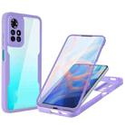 For Xiaomi Redmi Note 11 Acrylic + TPU 360 Degrees Full Coverage Phone Case(Purple) - 1