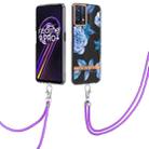 For OPPO Realme 9 Pro+ 5G Flowers Series TPU Phone Case with Lanyard(Blue Peony) - 1