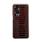 For Hono 70 Genuine Leather Weilai Series Nano Plating Phone Case(Coffee) - 1