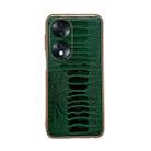 For Hono 70 Genuine Leather Weilai Series Nano Plating Phone Case(Green) - 1
