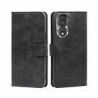 For Honor 80 Calf Texture Buckle Flip Leather Phone Case(Black) - 1