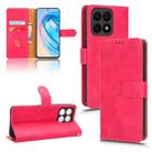 For Honor X8a Skin Feel Magnetic Flip Leather Phone Case(Rose Red) - 1