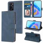 For OPPO A36 4G / A76 4G / A96 4G / Realme 9i 4G Fantasy Skin-feel Calfskin Texture Leather Phone Case(Blue) - 1