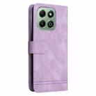 For Honor X6b Skin Feel Life Tree Metal Button Leather Phone Case(Purple) - 3