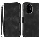 For Honor 300 Line Pattern Skin Feel Leather Phone Case(Black) - 1