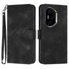 For Honor 300 Pro / Honor 300 Ultra Line Pattern Skin Feel Leather Phone Case(Black) - 1