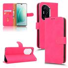 For Honor 300 Pro Skin Feel Magnetic Flip Leather Phone Case(Rose Red) - 1