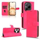 For Honor Power 5G Skin Feel Magnetic Flip Leather Phone Case(Rose Red) - 1