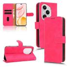 For Honor 400 Pro Global 160.8mm Skin Feel Magnetic Flip Leather Phone Case(Rose Red) - 1