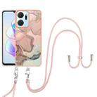 For Honor X7a Electroplating Marble Dual-side IMD Phone Case with Lanyard(Rose Gold 015) - 1