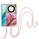 For Honor X9a / Magic5 Lite Electroplating Marble Dual-side IMD Phone Case with Lanyard(Rose Red 014) - 1