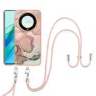 For Honor X9a / Magic5 Lite Electroplating Marble Dual-side IMD Phone Case with Lanyard(Rose Gold 015) - 1