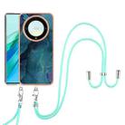 For Honor X9a / Magic5 Lite Electroplating Marble Dual-side IMD Phone Case with Lanyard(Green 017) - 1