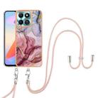 For Honor X6b Electroplating Marble Dual-side IMD Phone Case with Lanyard(Rose Red 014) - 2