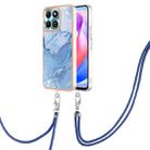 For Honor X6b Electroplating Marble Dual-side IMD Phone Case with Lanyard(Blue 018) - 1