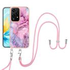 For Honor 200 Lite Global Electroplating Marble Dual-side IMD Phone Case with Lanyard(Pink 013) - 2