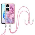 For Honor X7b 4G / 5G Electroplating Marble Dual-side IMD Phone Case with Lanyard(Pink 013) - 2