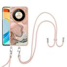 For Honor X9b Electroplating Marble Dual-side IMD Phone Case with Lanyard(Rose Gold 015) - 2