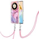 For Honor X9b Electroplating Marble Dual-side IMD Phone Case with Lanyard(Pink 013) - 1