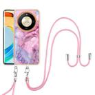 For Honor X9b Electroplating Marble Dual-side IMD Phone Case with Lanyard(Pink 013) - 2