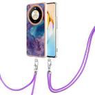 For Honor X9b Electroplating Marble Dual-side IMD Phone Case with Lanyard(Purple 016) - 1