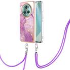 For Honor Magic5 Pro Electroplating Marble Dual-side IMD Phone Case with Lanyard(Purple 001) - 1