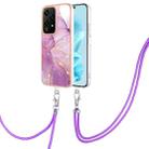 For Honor 200 Lite Global Electroplating Marble Dual-side IMD Phone Case with Lanyard(Purple 001) - 1