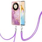 For Honor X9b Electroplating Marble Dual-side IMD Phone Case with Lanyard(Purple 001) - 1