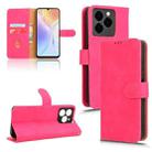 For Ulefone Note 20 Pro Skin Feel Magnetic Flip Leather Phone Case(Rose Red) - 1