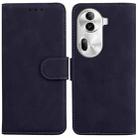 For OPPO Reno11 Pro 5G Global Skin Feel Pure Color Flip Leather Phone Case(Black) - 1