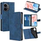 For Honor 400 Global 156.5mm Skin Feel Crocodile Magnetic Clasp Leather Phone Case(Blue) - 1