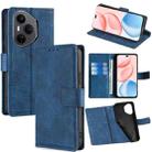 For Honor 400 Pro Global 160.8mm Skin Feel Crocodile Magnetic Clasp Leather Phone Case(Blue) - 1