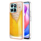 For Honor X6a Electroplating Marble Dual-side IMD Phone Case(Draft Beer) - 1