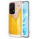 For Honor 200 Lite Global Electroplating Marble Dual-side IMD Phone Case(Draft Beer) - 1