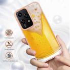 For Honor 200 Lite Global Electroplating Marble Dual-side IMD Phone Case(Draft Beer) - 2