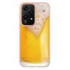 For Honor 200 Lite Global Electroplating Marble Dual-side IMD Phone Case(Draft Beer) - 3