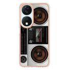 For Honor X7b 4G / 5G Electroplating Marble Dual-side IMD Phone Case(Retro Radio) - 3