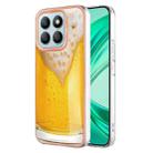 For Honor X8b Electroplating Marble Dual-side IMD Phone Case(Draft Beer) - 1